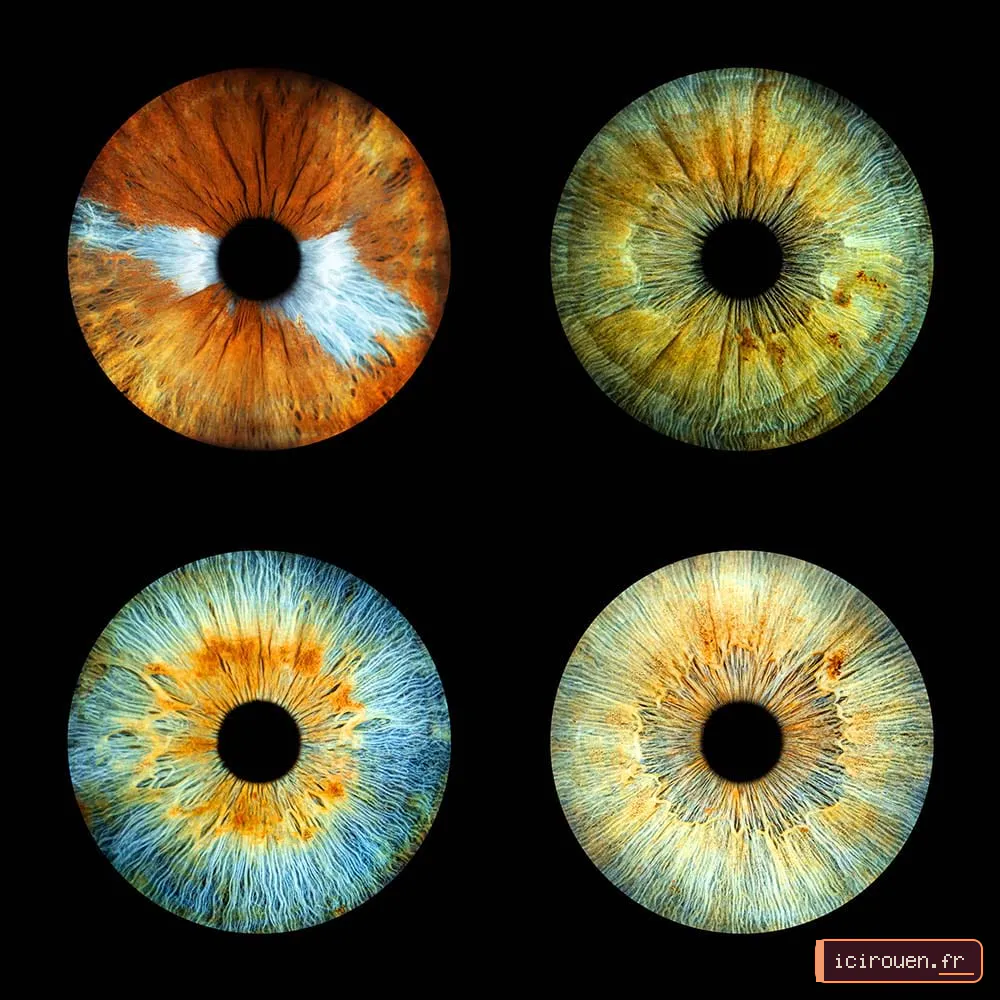 4 Iris